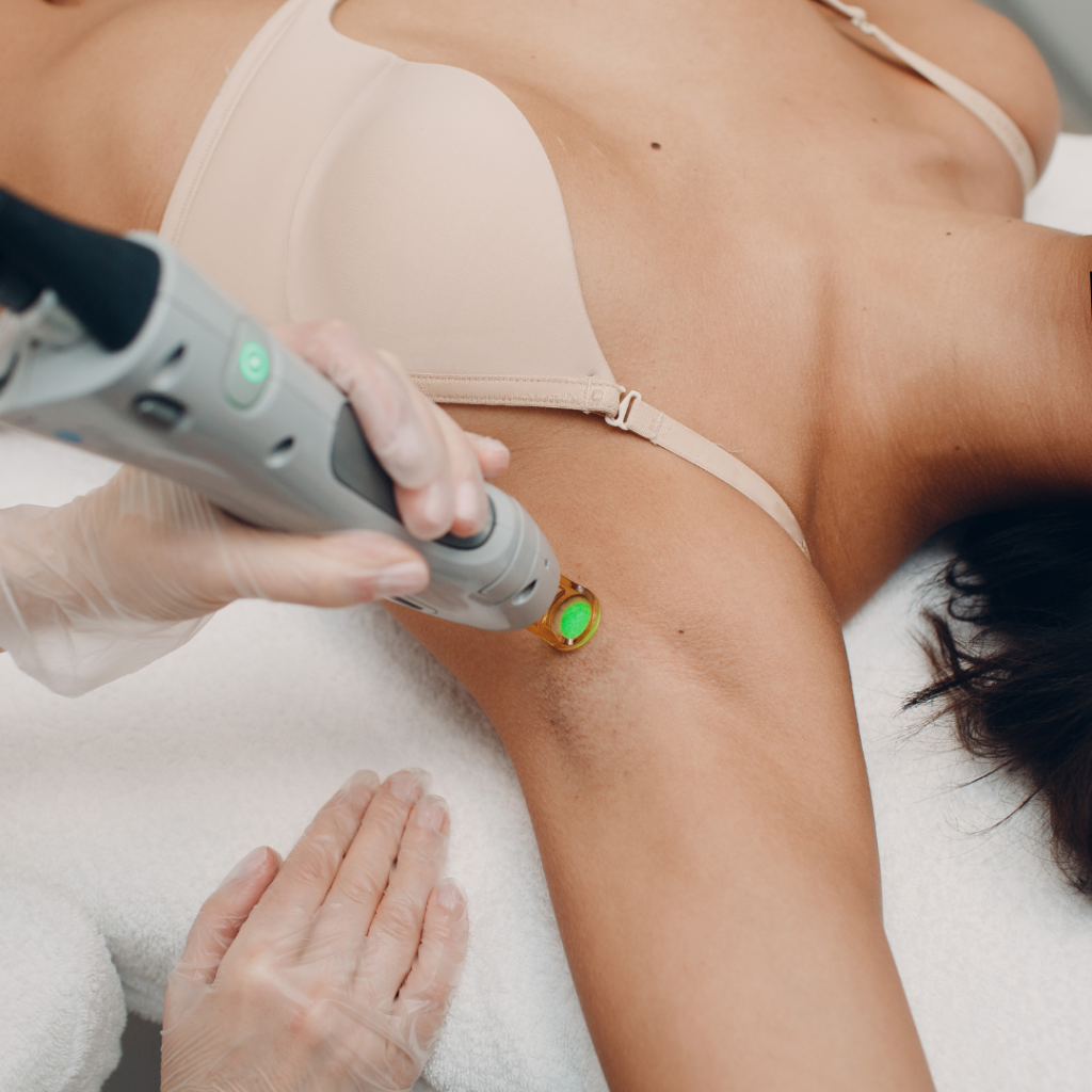 Laser Hair Reduction underarms at facelit