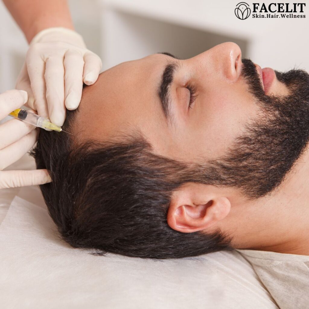 Best Hair Clinic in Trivandrum a man done hair treatment at facelit