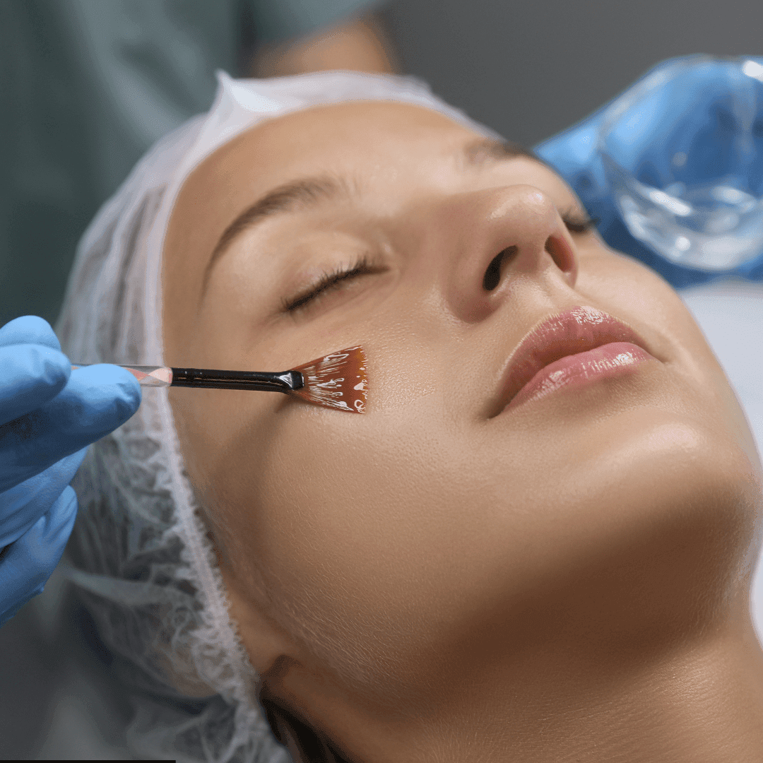 Chemical Peel Before and After: in Trivandrum, Kerala