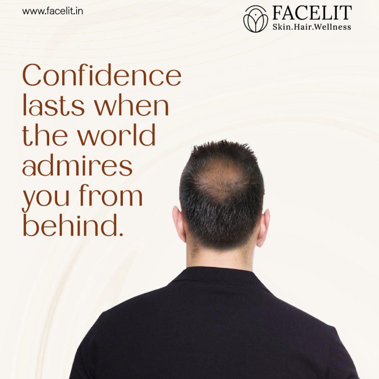 Best Hair Clinic in Trivandrum