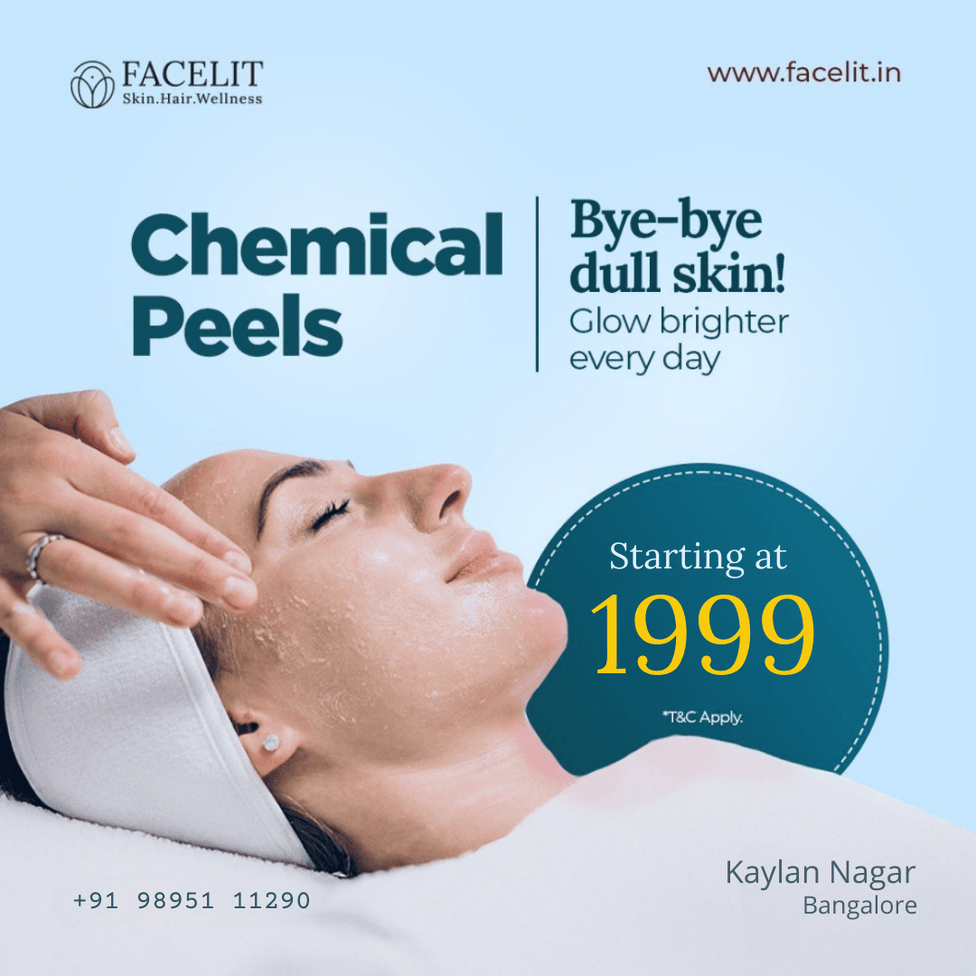 Best Chemical Peel in Bangalore