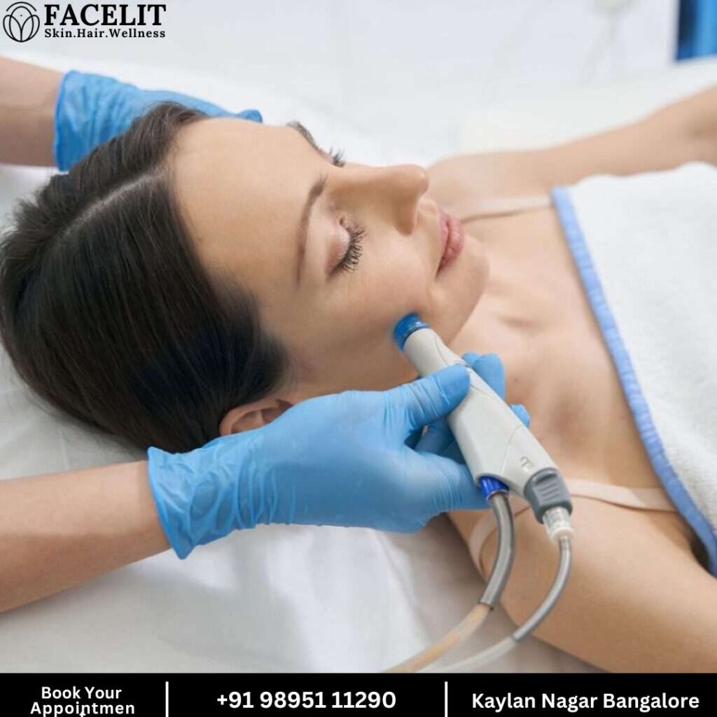 Best Hydrafacial in Kalyan Nagar