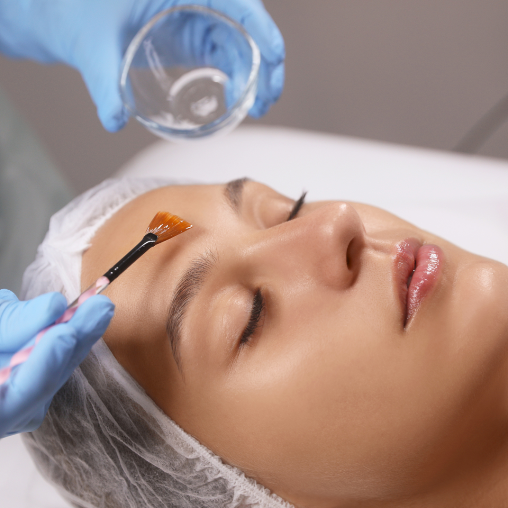 chemical peel treatment taken by women at facelit clinic