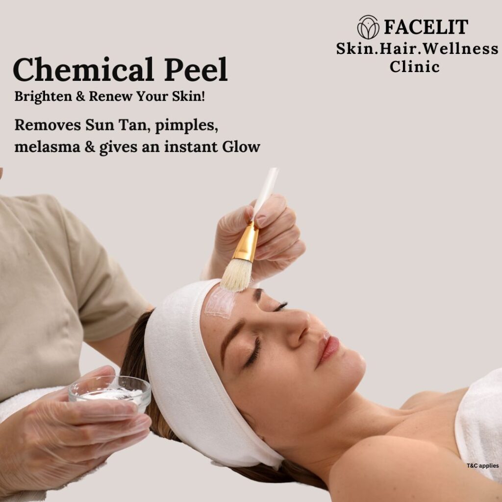 best peels in Kalyan Nagar