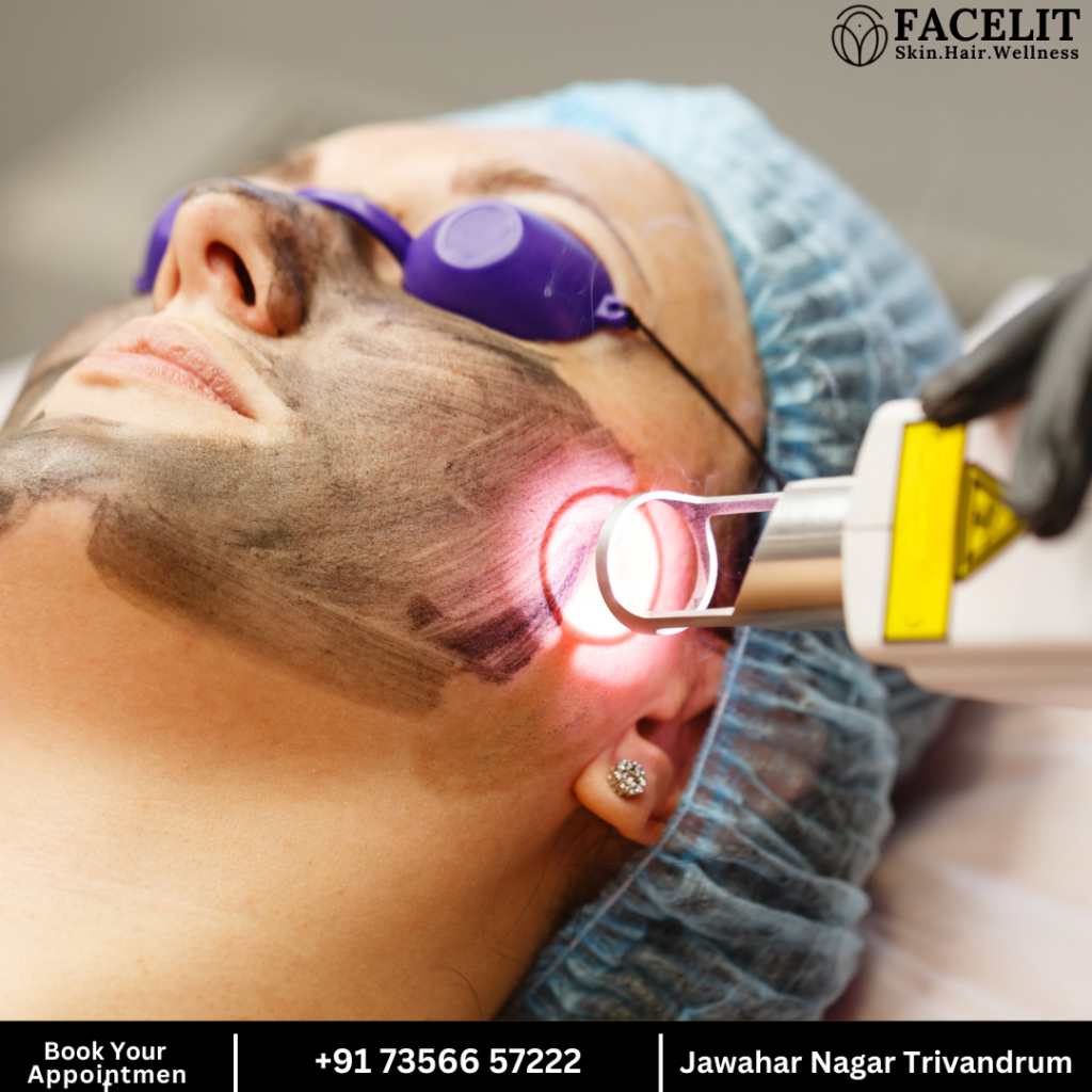 Best Skin Lightening Laser Treatment in Trivandrum