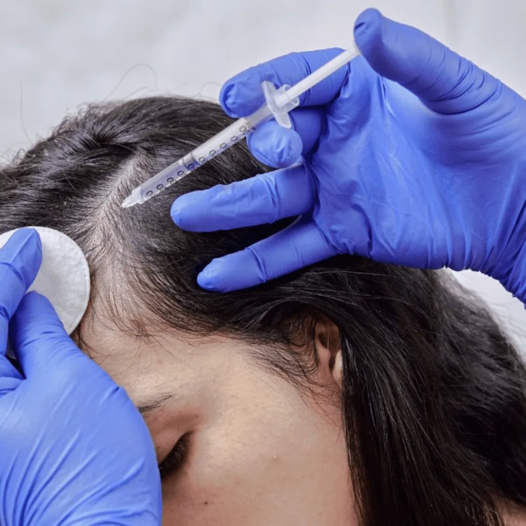 QR 678 Hair loss treatment at facelit clinic