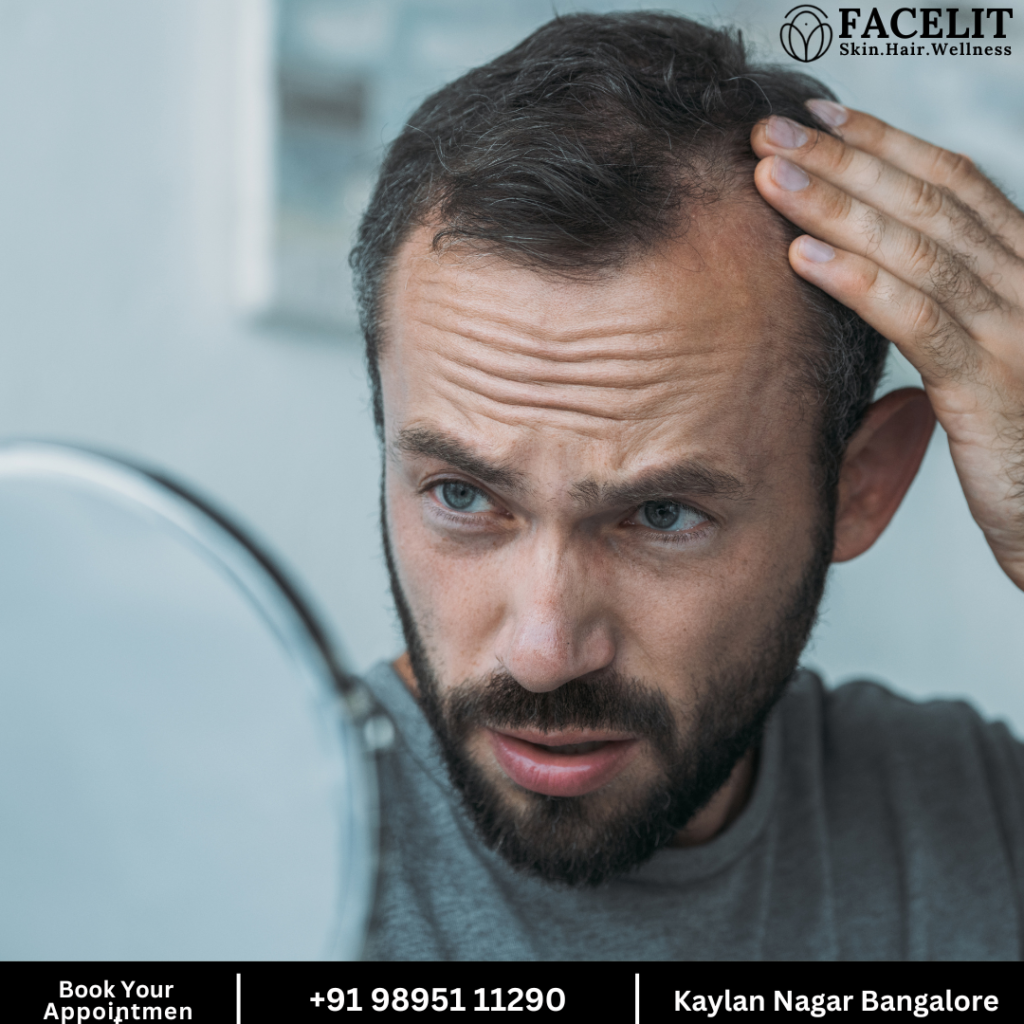 Best Hair Loss Treatment in Bangalore