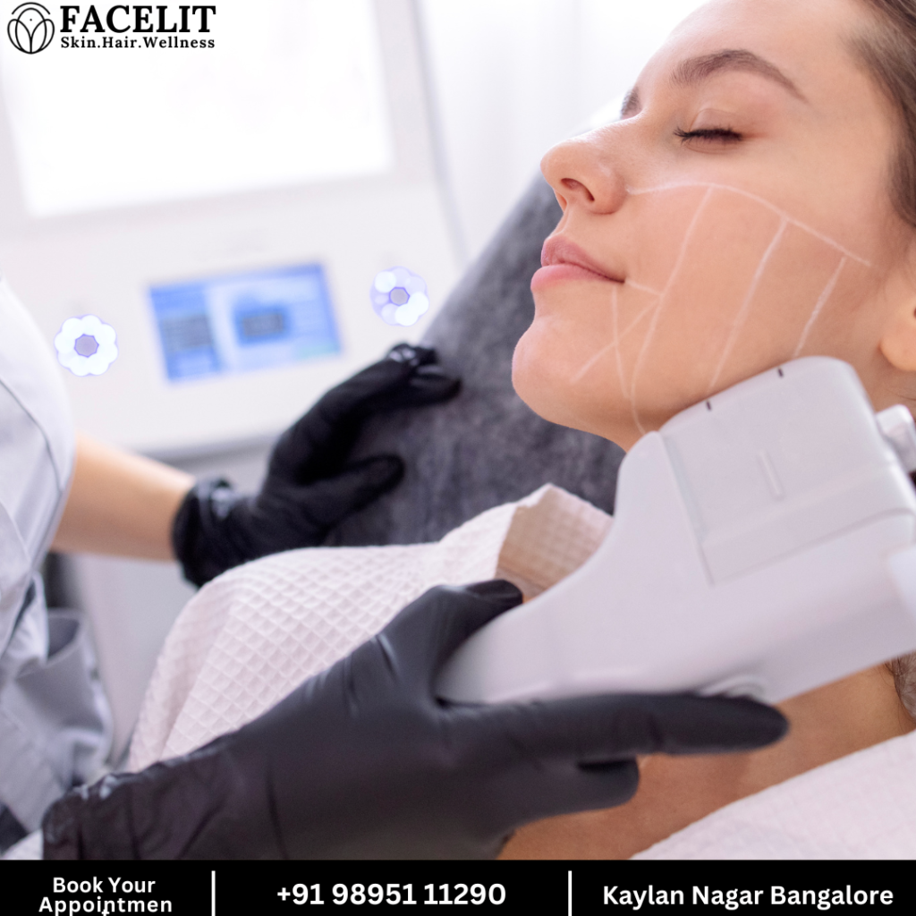 Jawline Lift Treatment at Facelit Clinic Bangalore