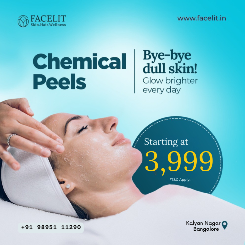 Chemical Peel Treatments for Sensitive Skin in Bengaluru