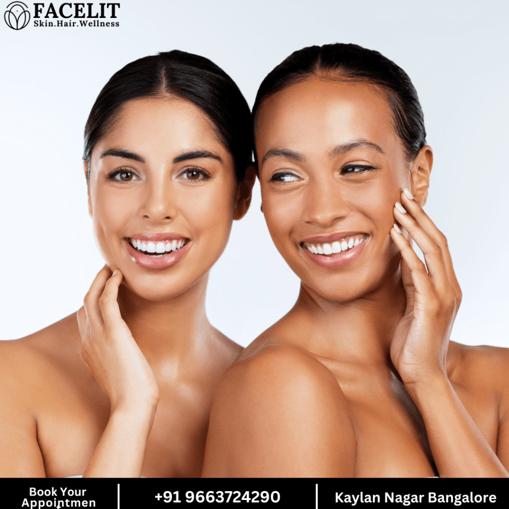 Best Profhilo Treatment in Bangalore