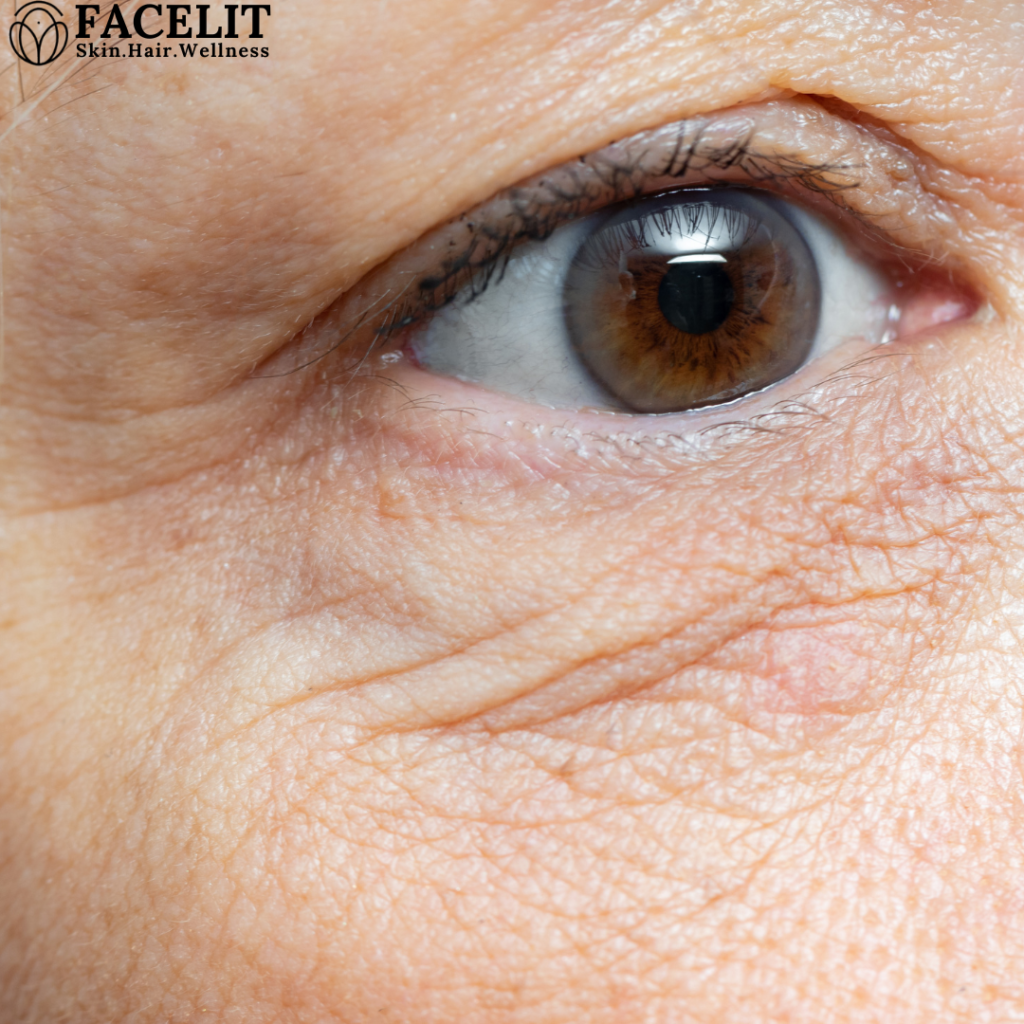 5 Best Ways to Treat Your Under-Eye Aging