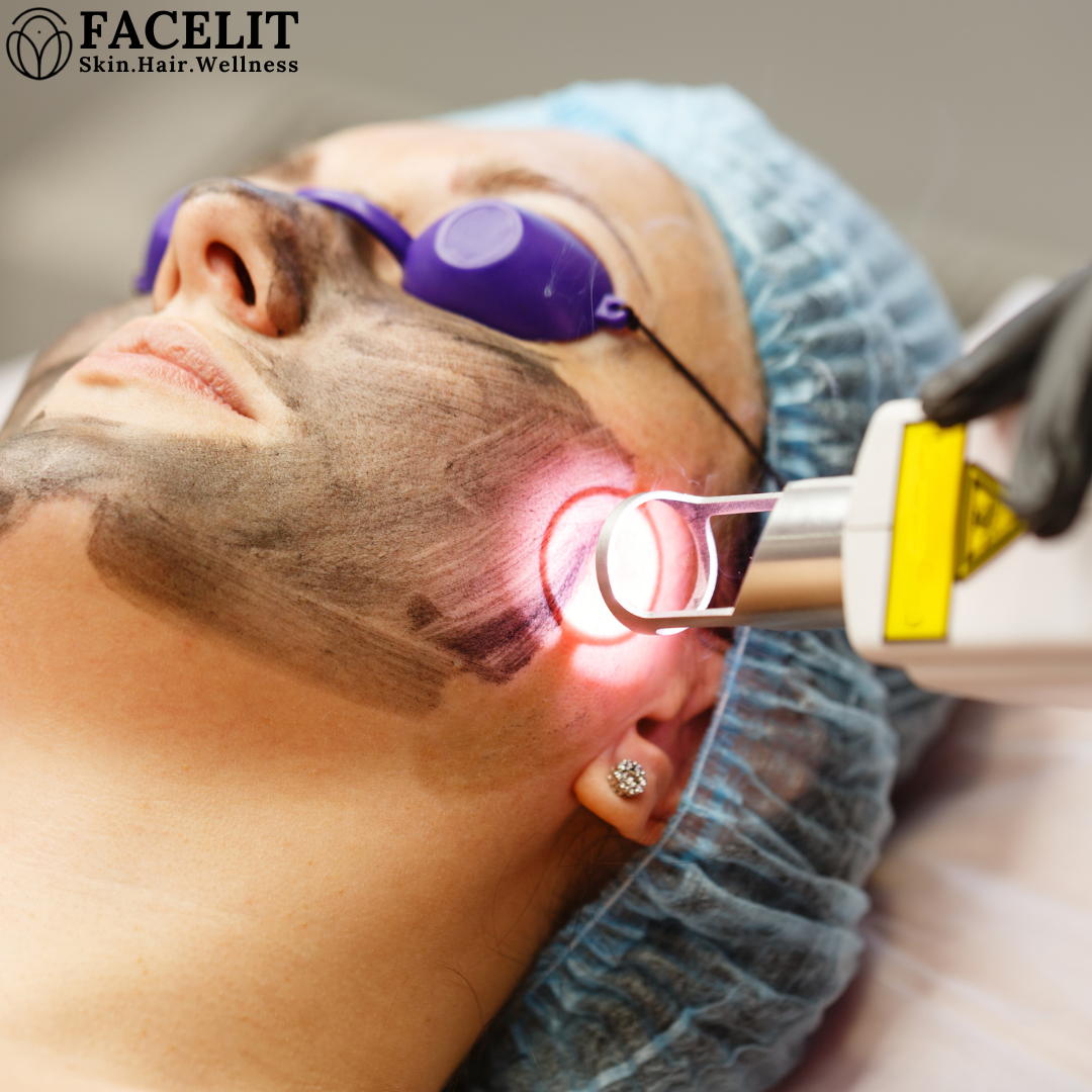 Best Laser Treatments to Remove Sun Tan Effectively