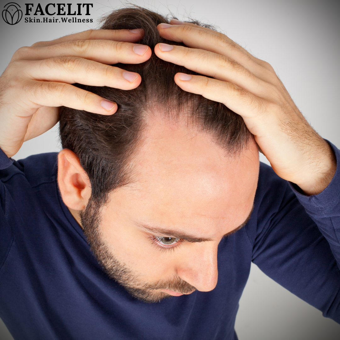 Hair Loss Symptoms Causes & Treatments