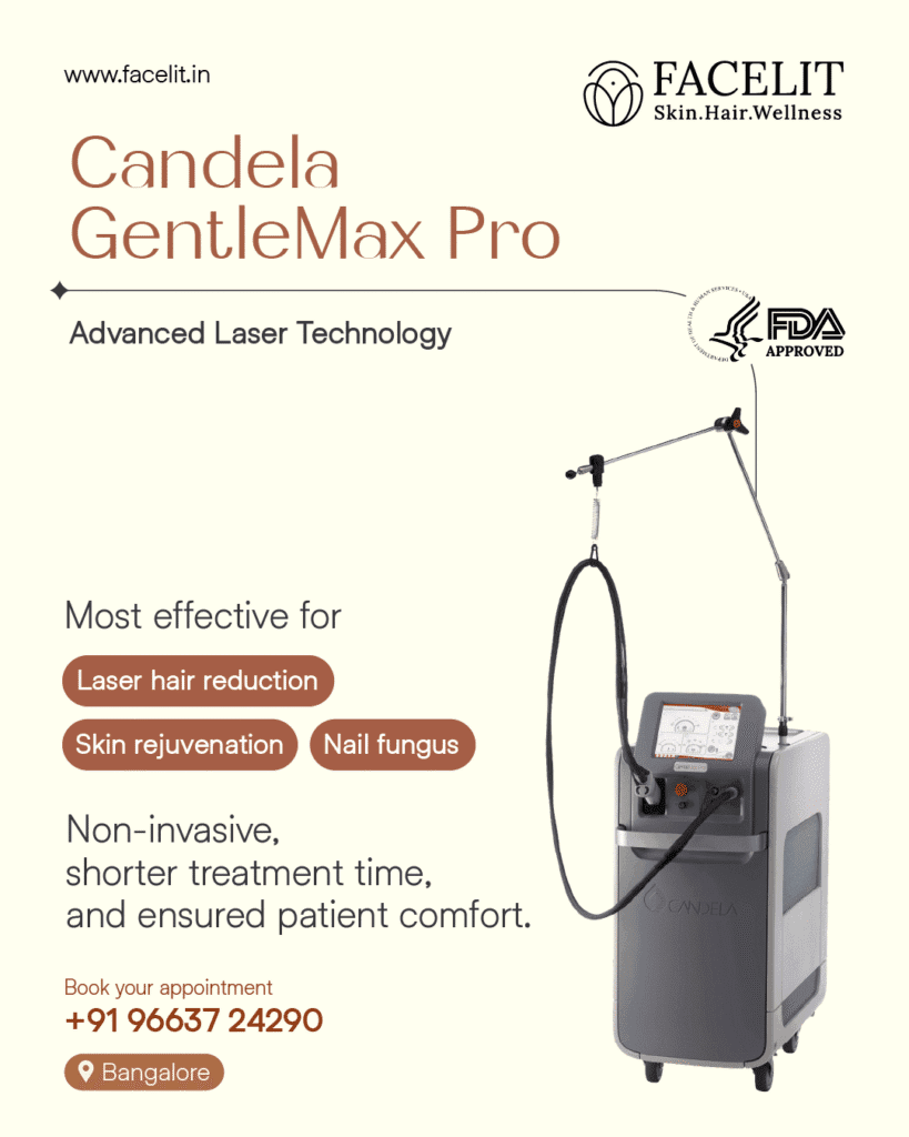 Candela Nd.YAG. GentleMax Pro