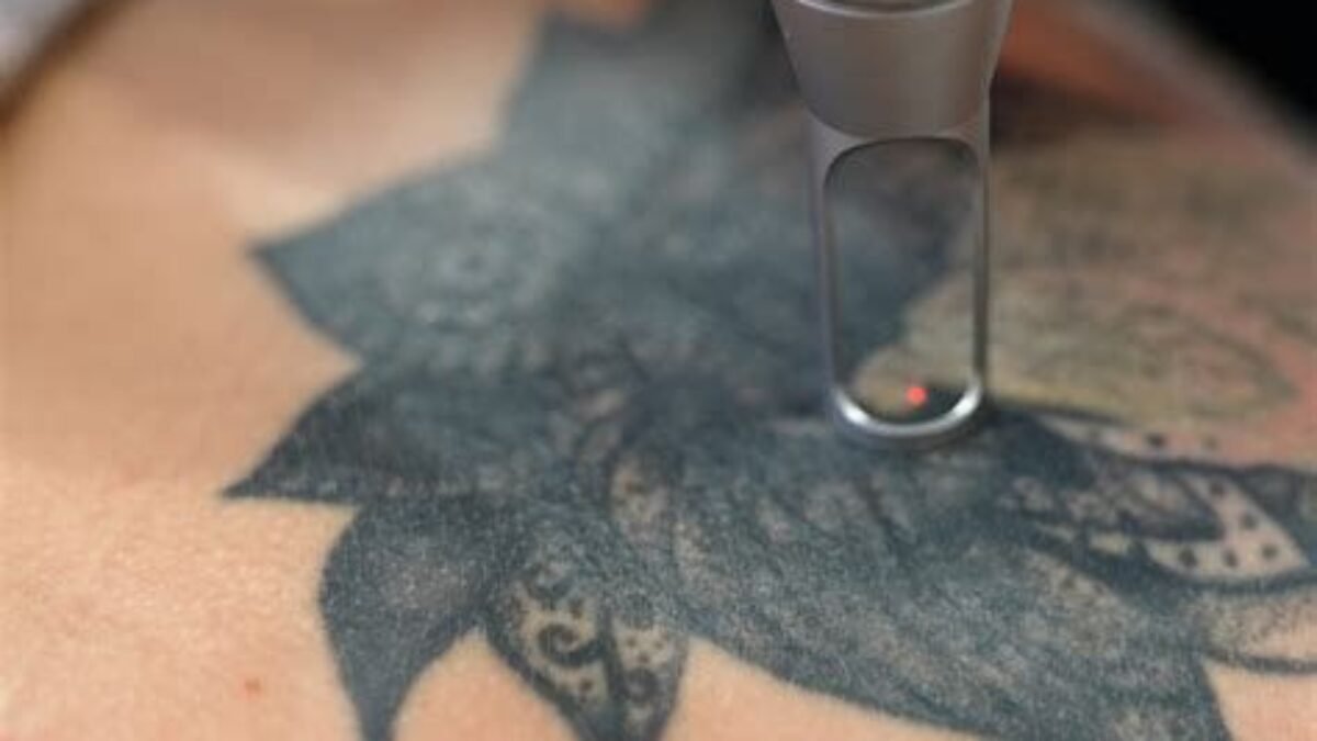 does glutathione fade tattoos Why My Tattoo Look Faded? 8 Causes  Hush Anesthetic 3 Things to Know About
