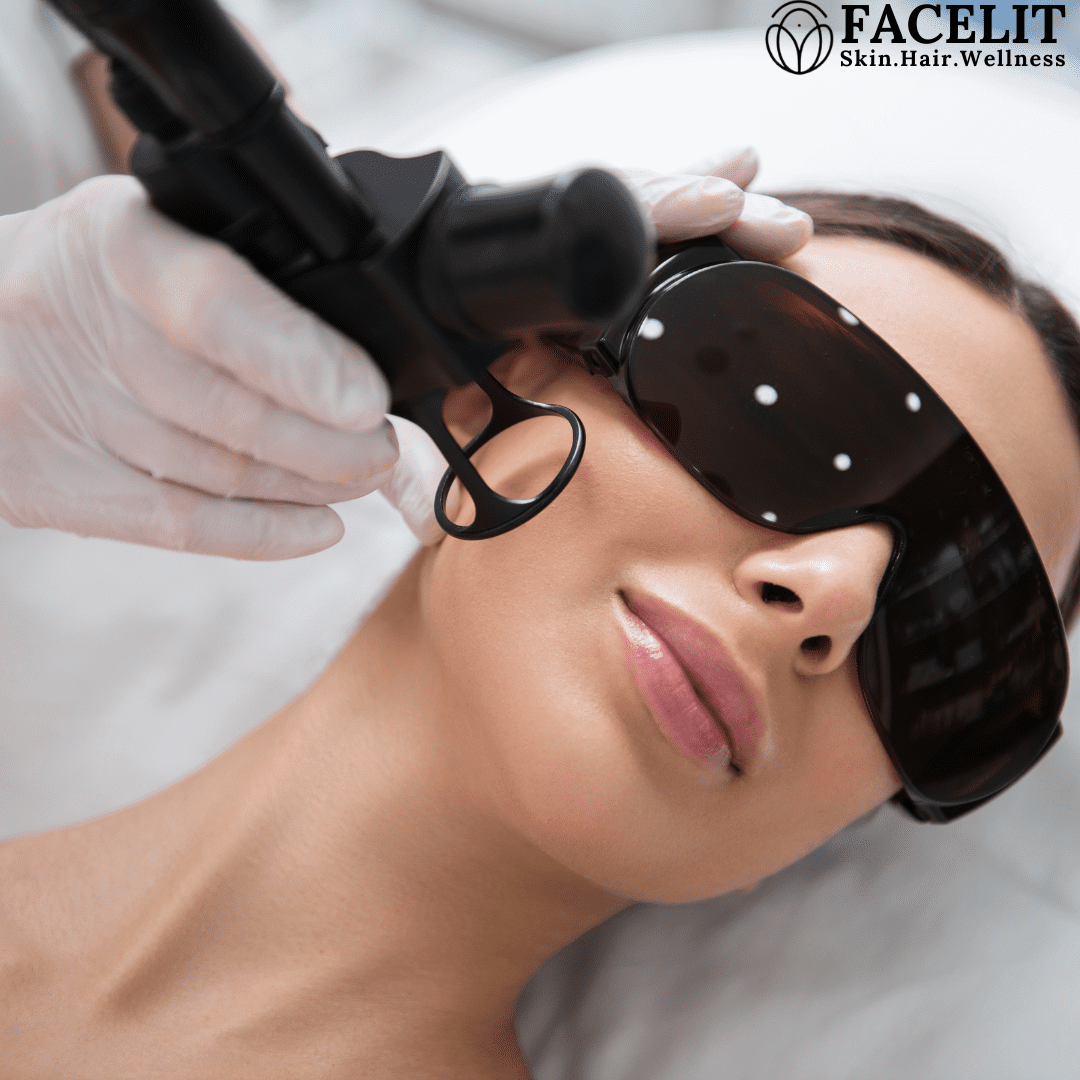 CO2 Laser How Does It Improve Your Skin