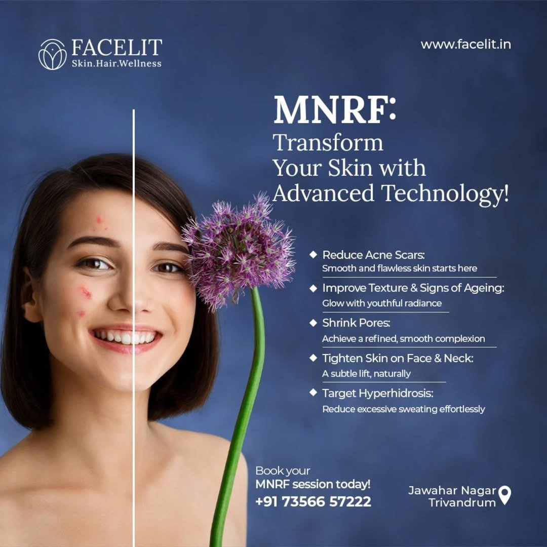 MNRF Why It is a Popular Treatment for Skin Rejuvenation