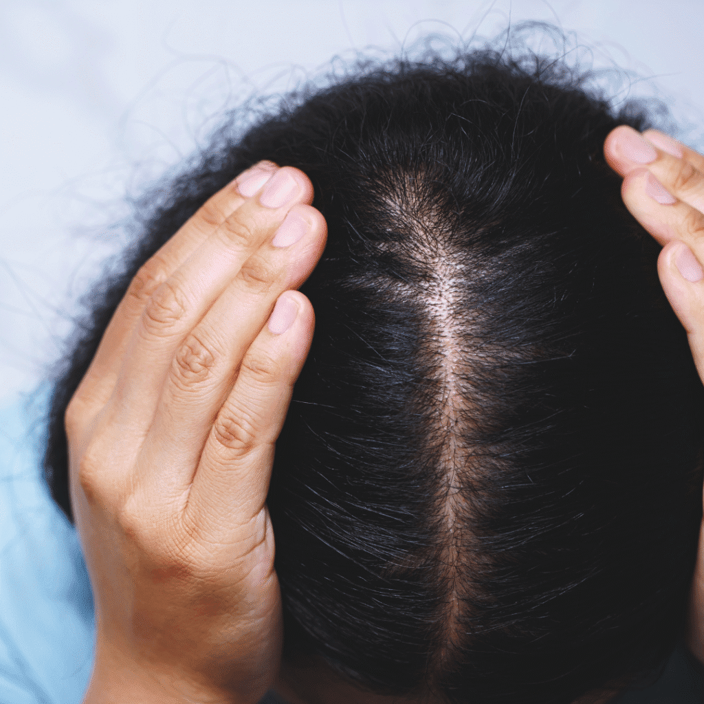 Best hair loss treatment in Coimbatore