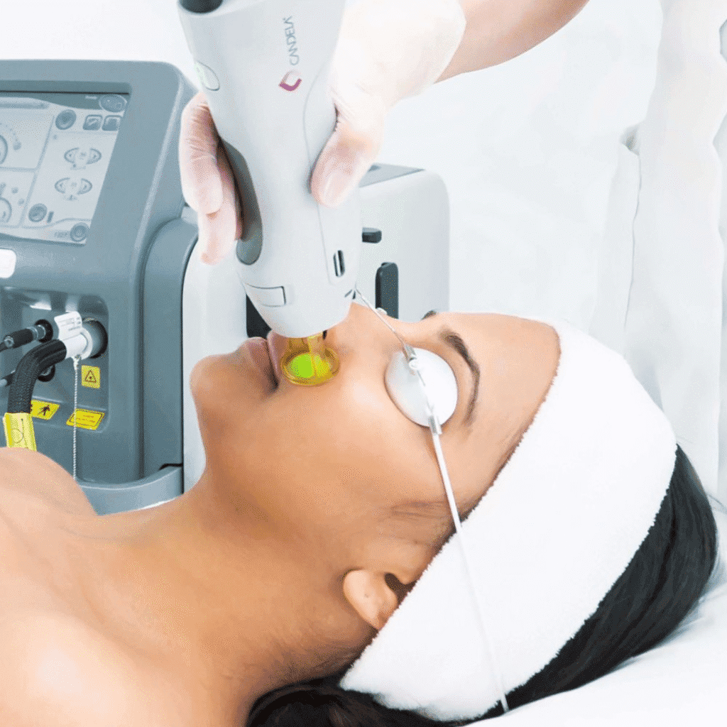 Cost Of Full Body Laser Hair Removal In Bangalore