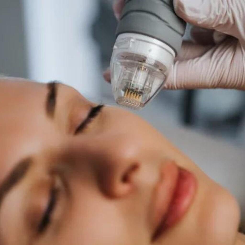 best mnrf treatment at facelit clinic